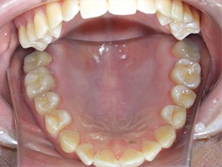 カラム_02 イメージ