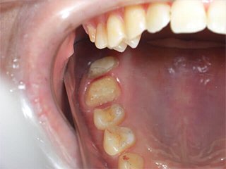 カラム_02 イメージ