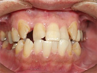 カラム_02 イメージ